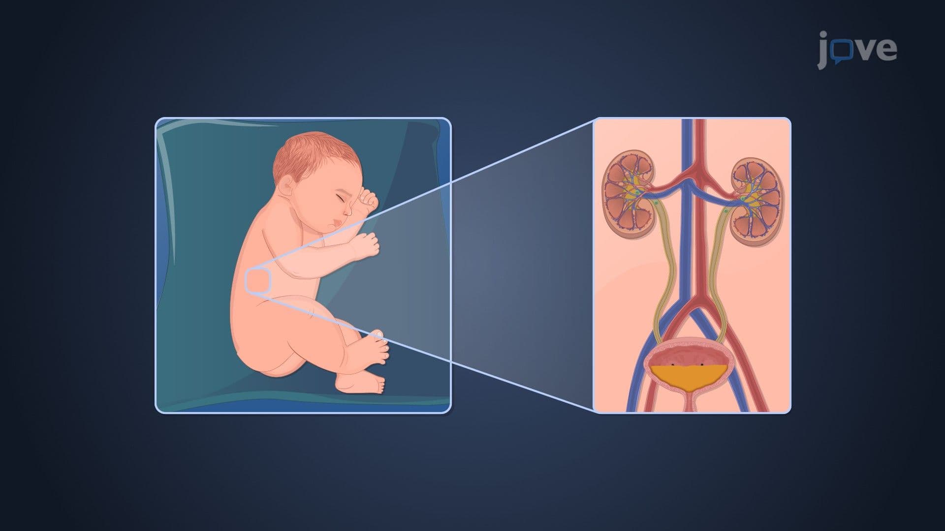 Pharmacokinetics in Pediatric Patients: Drug Excretion