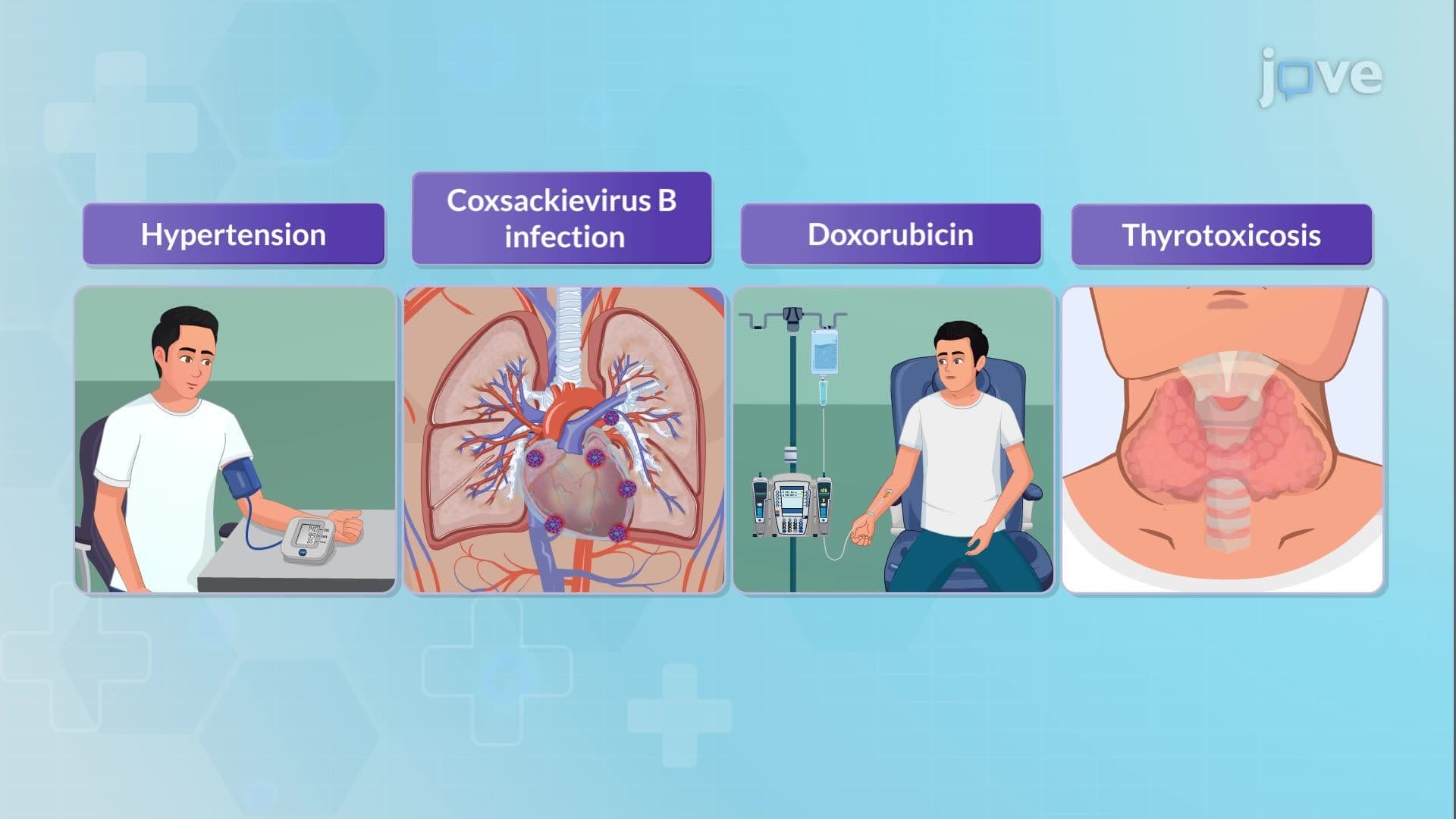 Cardiomyopathy II: Dilated Cardiomyopathy