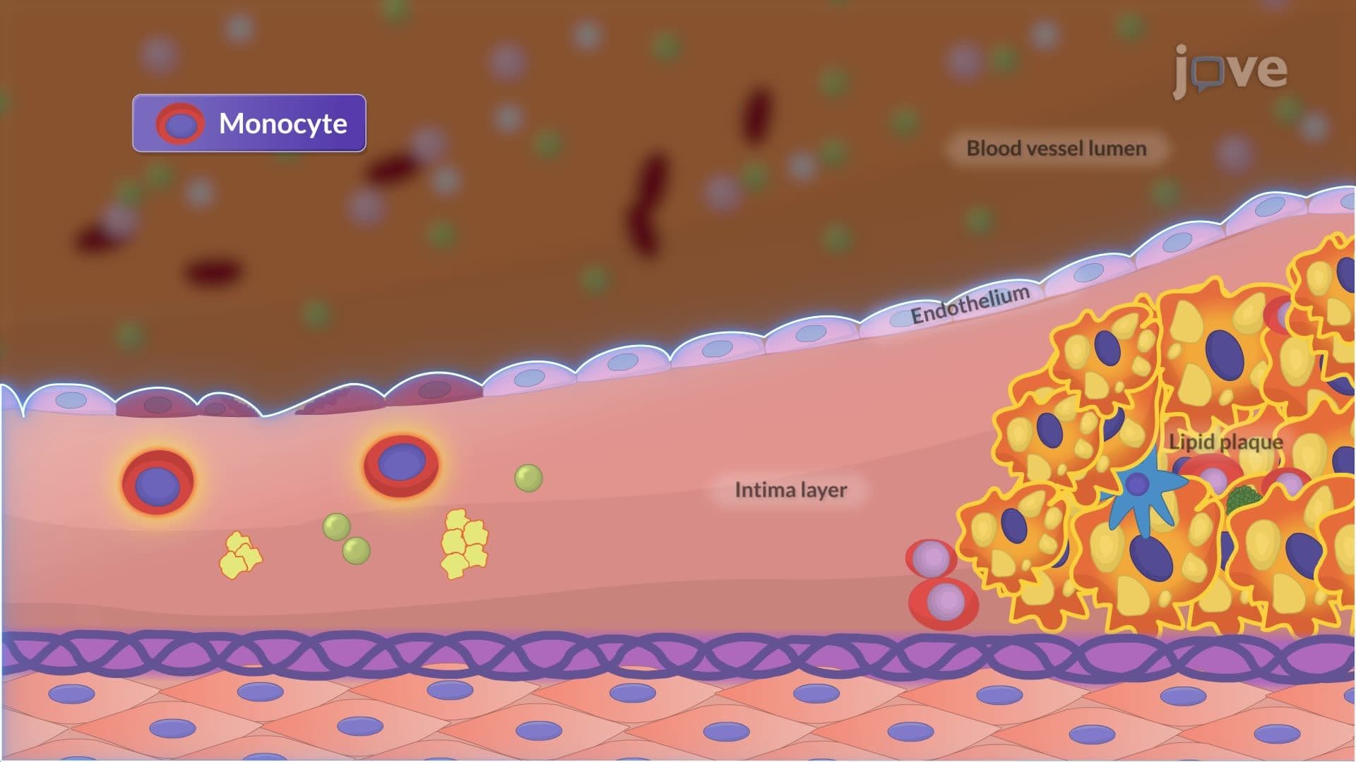Atherosclerosis I: Introduction