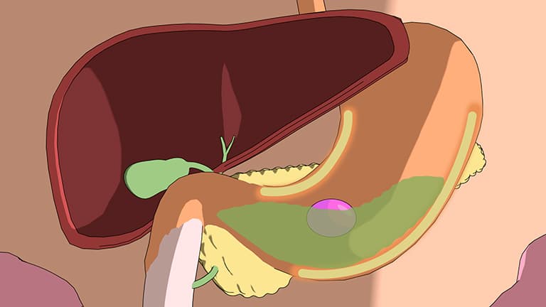 Hormonal Regulation of Digestion