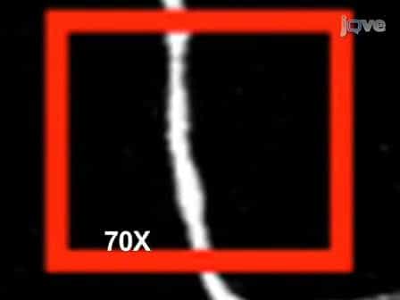 Two-photon axotomy and time-lapse confocal imaging in live zebrafish embryos