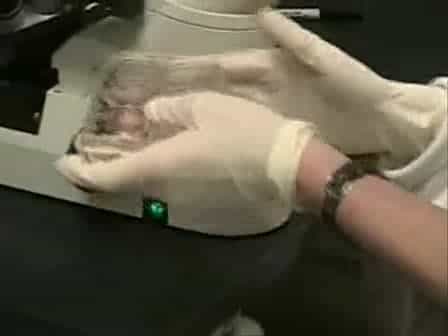 Propagation of Human Embryonic Stem (ES) Cells