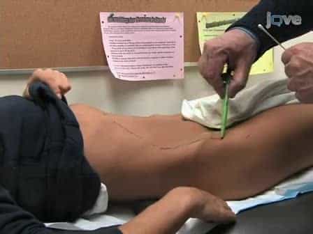 Demonstration of Cutaneous Allodynia in Association with Chronic Pelvic Pain