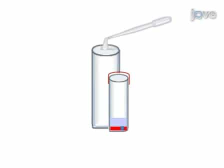 Cell Block Preparation from Cytology Specimen with Predominance of Individually Scattered Cells
