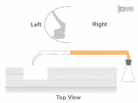 Combining Peripheral Nerve Grafting and Matrix Modulation to Repair the Injured Rat Spinal Cord