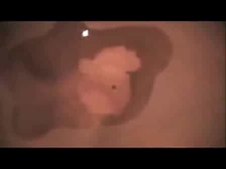 Growth Factor-Coated Bead Placement on Dorsal Forebrain Explants