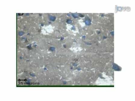 Obtaining High Quality RNA from Single Cell Populations in Human Postmortem Brain Tissue