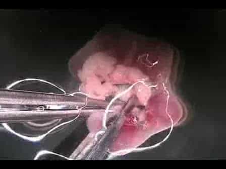 Dissection of 6.5 dpc Mouse Embryos
