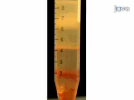 Neutrophil Extracellular Traps: How to Generate and Visualize Them
