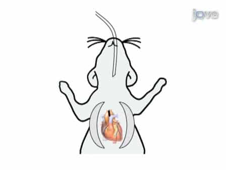 Transverse Aortic Constriction in Mice