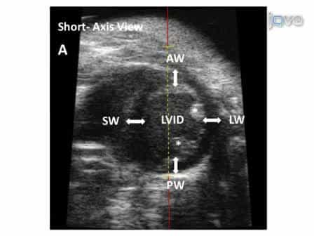 Transthoracic Echocardiography in Mice