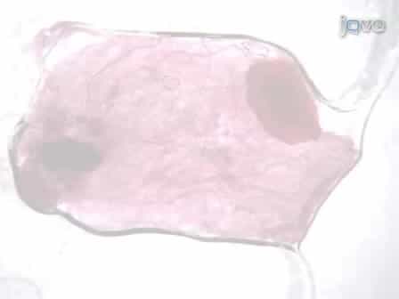 Mammary Epithelial Transplant Procedure