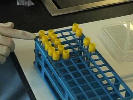 Measuring the 50% Haemolytic Complement (CH50) Activity of Serum