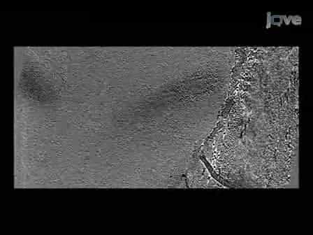 Electron Cryotomography of Bacterial Cells