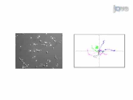 Human T Lymphocyte Isolation, Culture and Analysis of Migration In Vitro