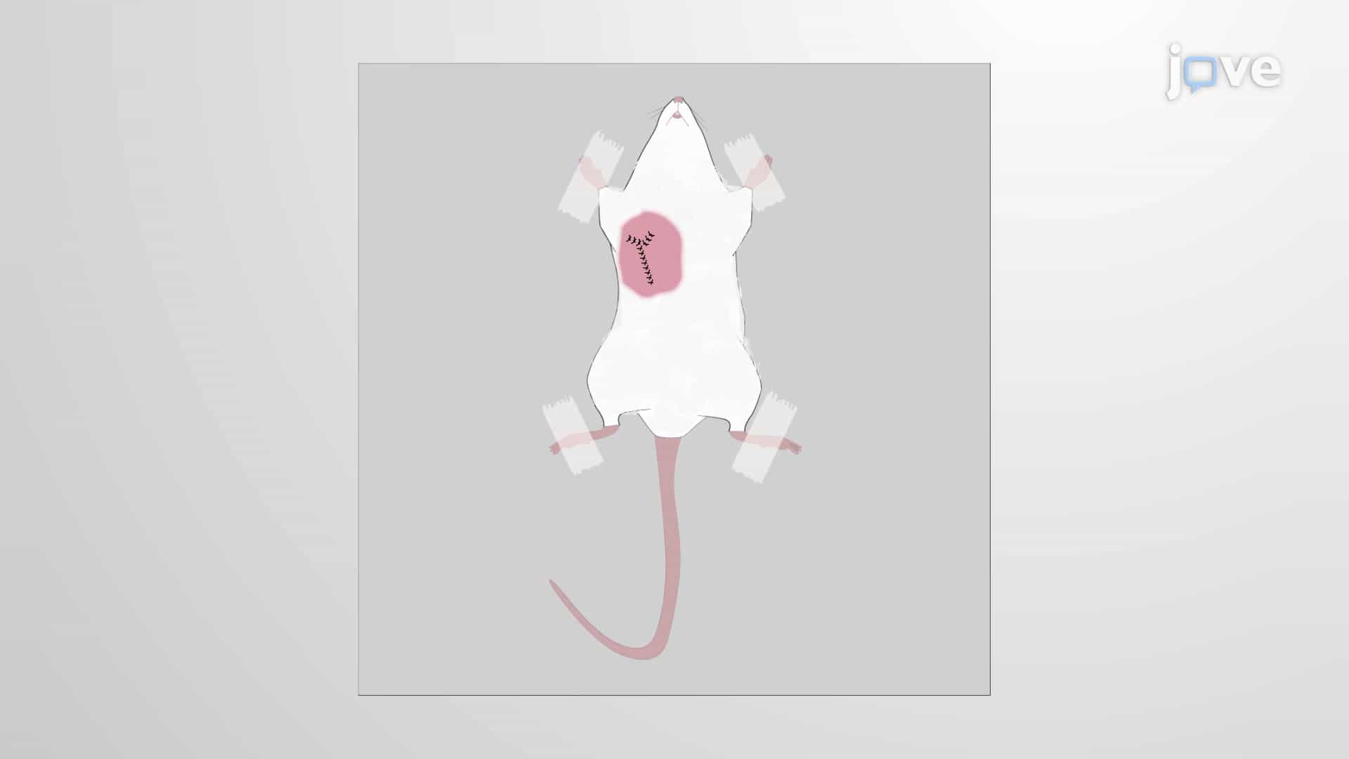 Radical Mastectomy: Surgical Removal of the Entire Mammary Gland from a Mouse to Study Cancer Progression