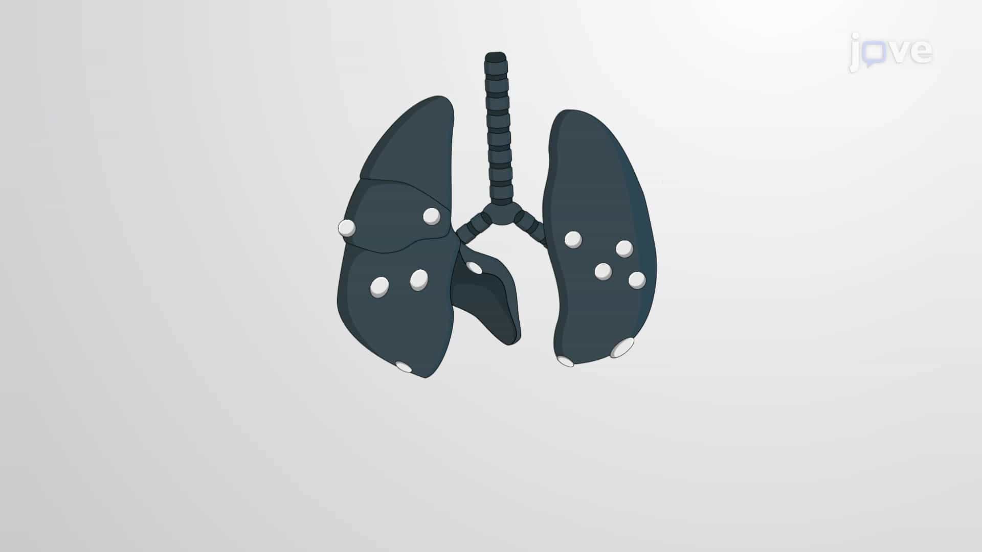 India Ink Inflation: A Staining Method to Visualize Tumor Nodules