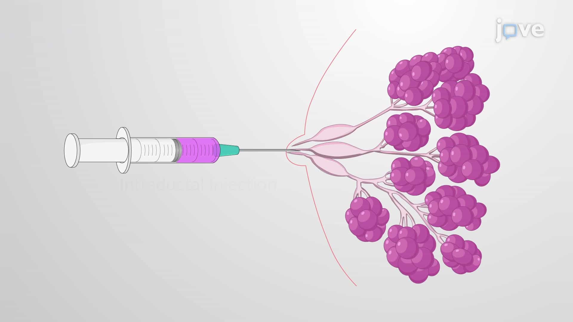Rabbit Intraductal Injection: Localized Delivery of Solution of Interest into the Rabbit Mammary Gland