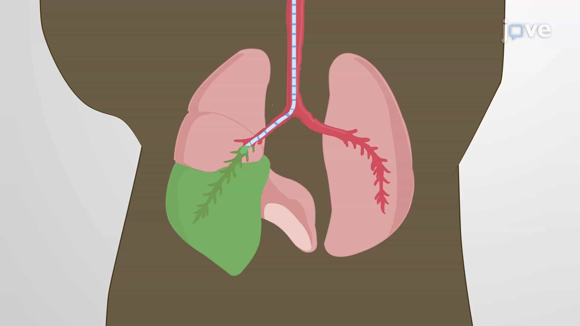 Intrabronchial Delivery: A Technique to Administer an Experimental Agent Selectively Into a Mouse Lung