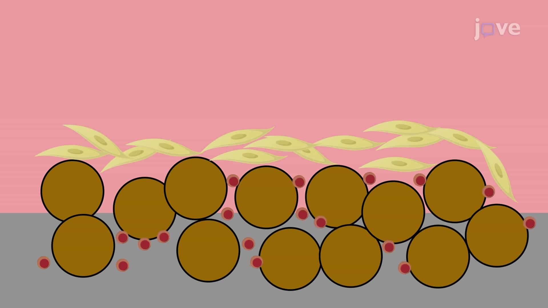 G-10 Column Based Leukemia Cell Sorting: A Method to Purify Acute Lymphoblastic Leukemia Cells from Bone Marrow Stromal Cells