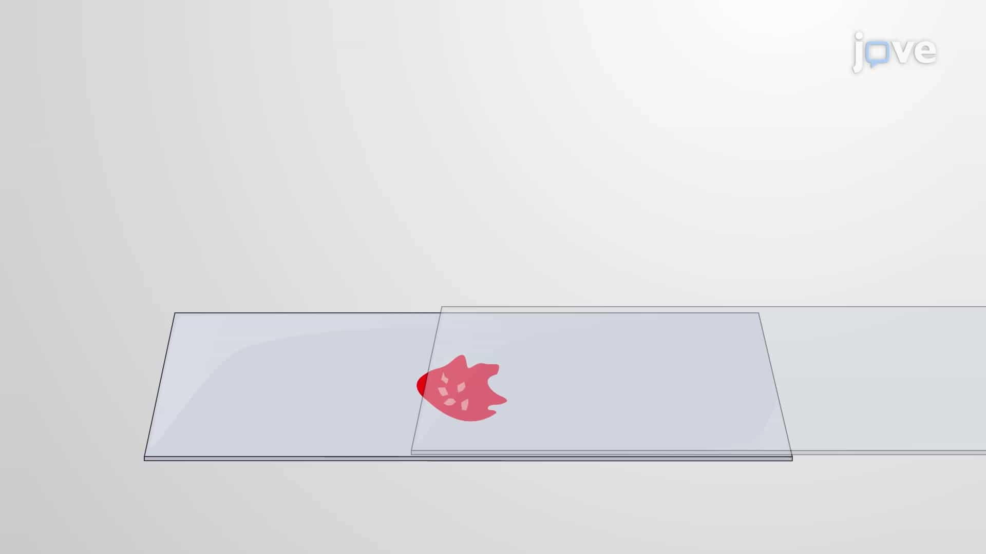 Bone Marrow Aspiration: A Method to Obtain Bone Marrow to Examine Cell Morphology