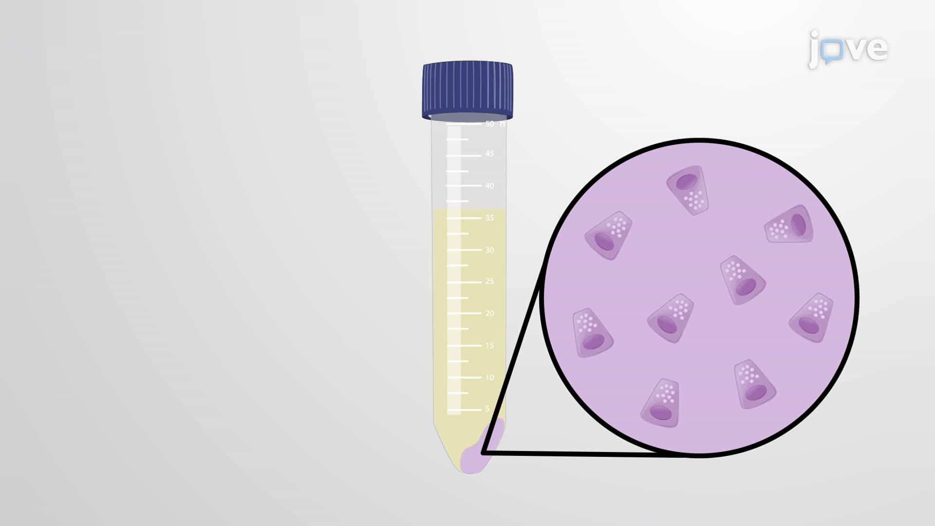 Primary Acinar Cell Isolation: A Method to Isolate Acinar Cells from Mouse Pancreas