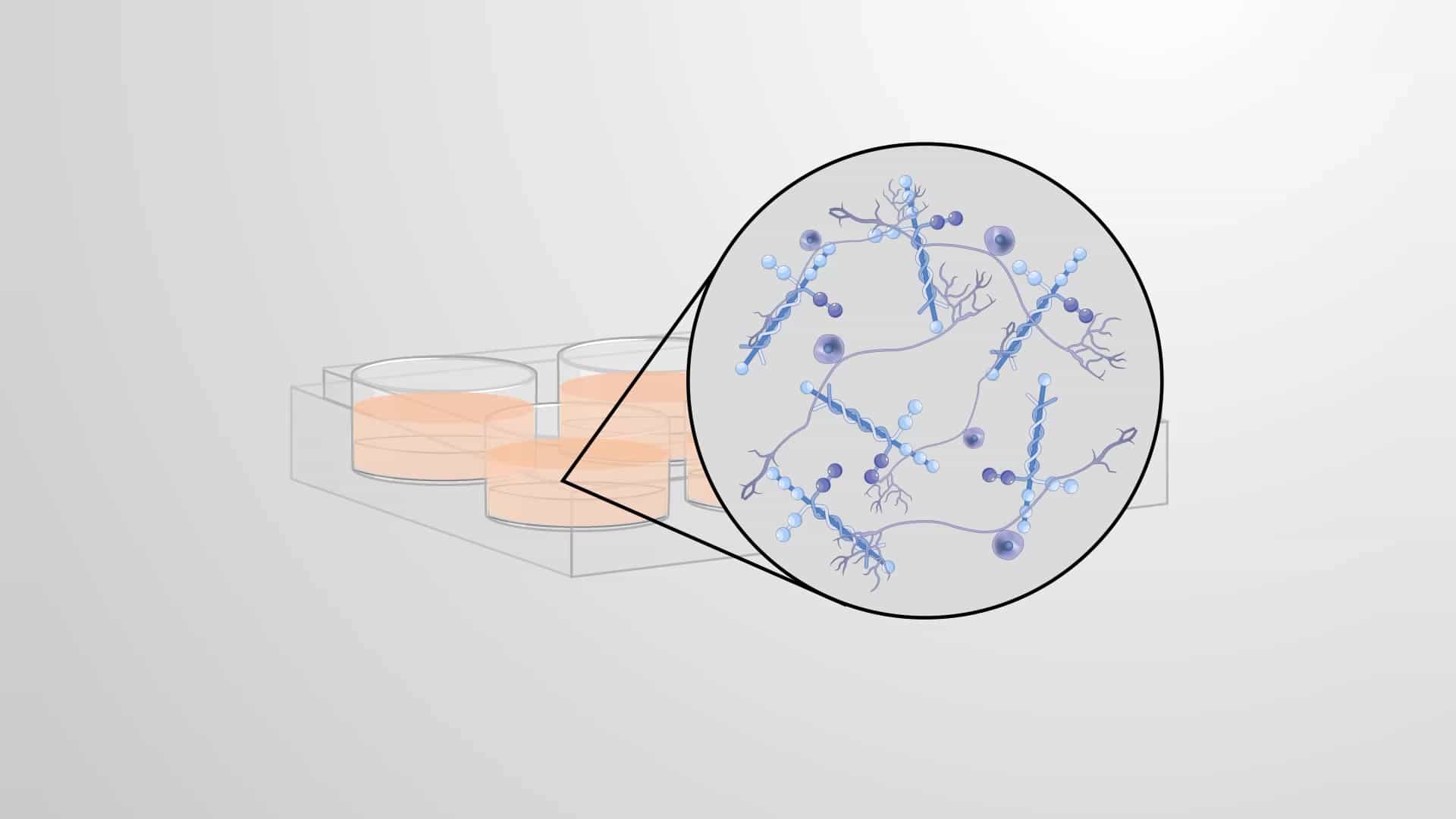 In Vitro Pancreatic Neuroplasticity Assay: Studying Changes in GI Tract Neurons Exposed to Healthy and Cancerous Human Pancreatic Tissue Extracts