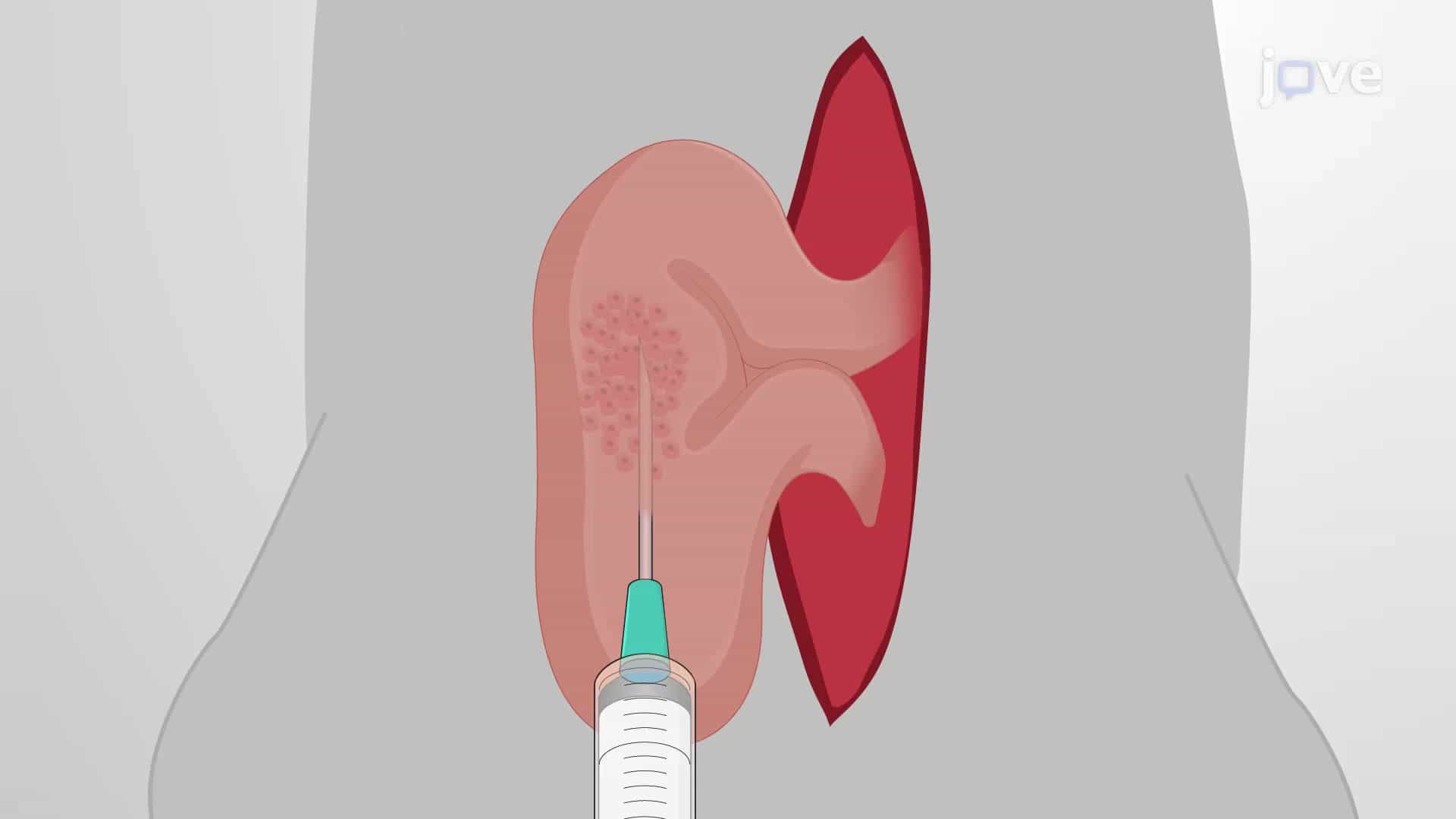 Intracecal Tumor Cell Injection: A Technique to Deliver Cancer Cells for Establishing Orthotopic Colorectal Cancer Mouse Model