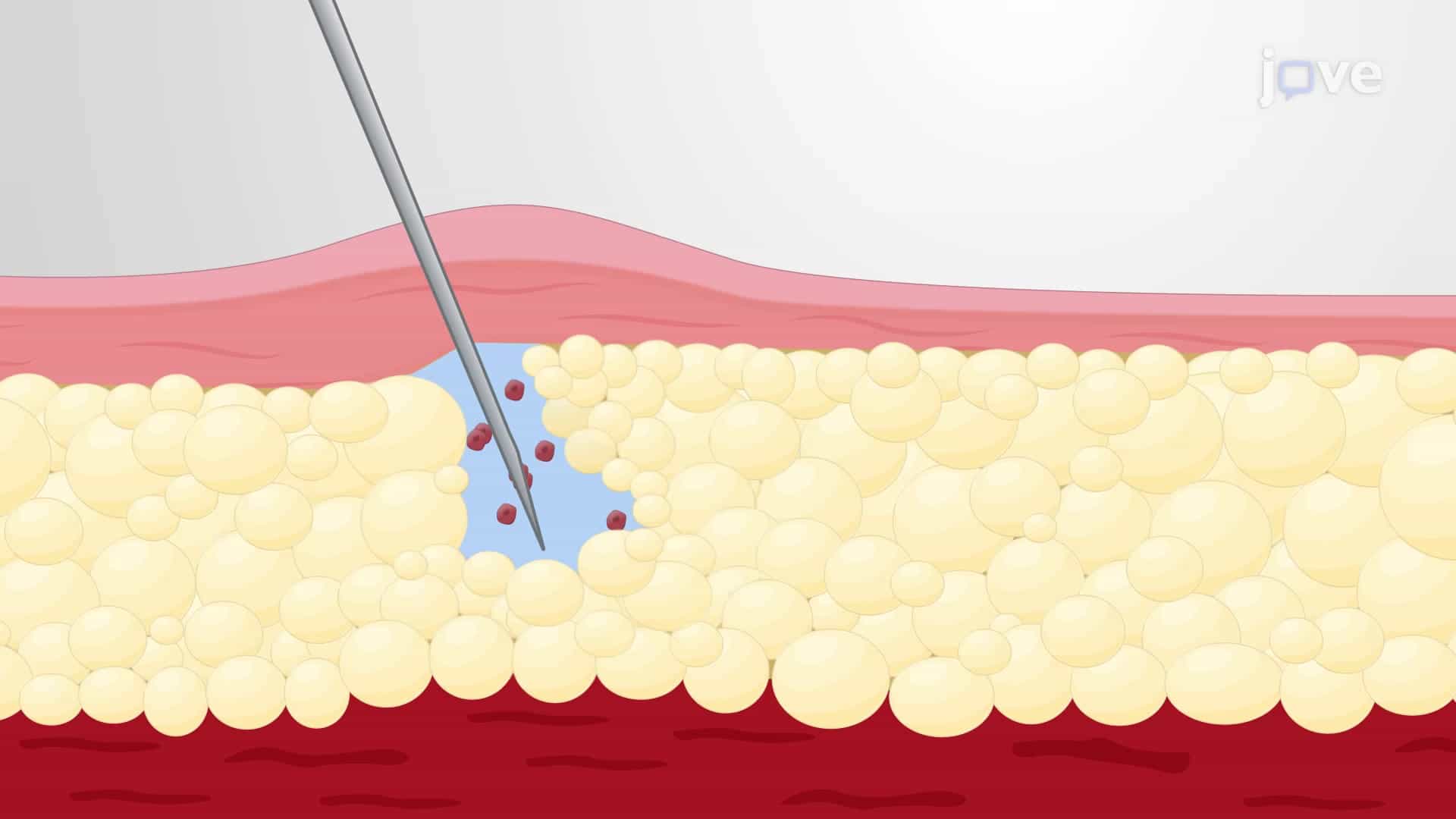 Ovarian Fat Pad Transplantation Assay: An In Vivo Technique to Introduce Cells into Ovarian Fat Pad in Mouse Models