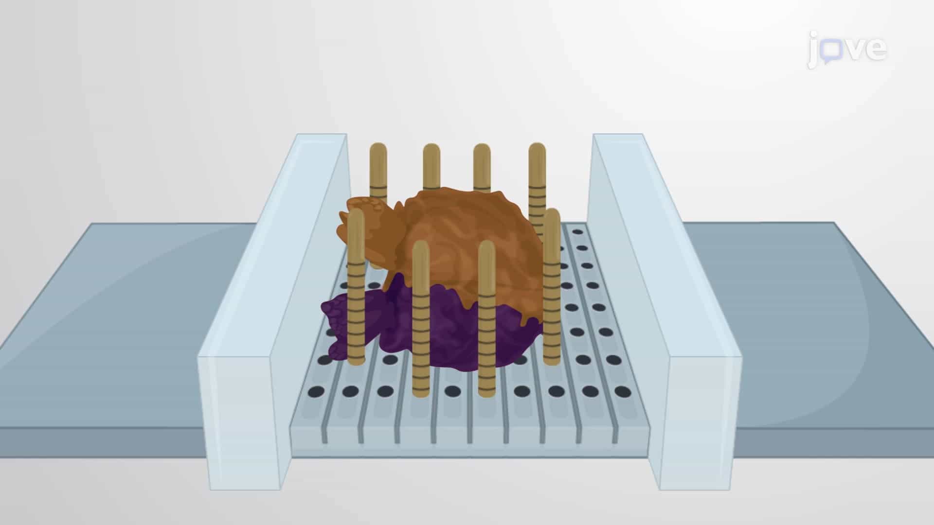 Sampling Prostate Cancer Tissue for Biobanking: An MRI-guided Targeted Technique to Remove Biopsy Punches from Fresh Tumor Tissue