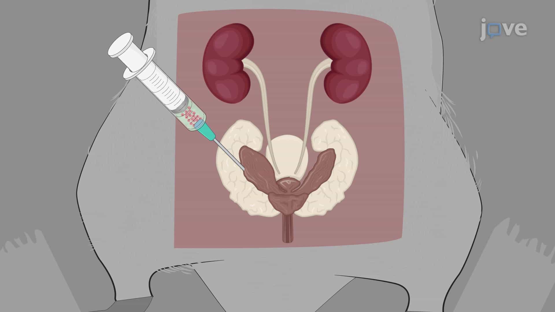 Intra-prostatic Injection of Cancer Cells: A Technique to Deliver Cancer Cells for Establishing Orthotopic Prostate Cancer Mouse Model