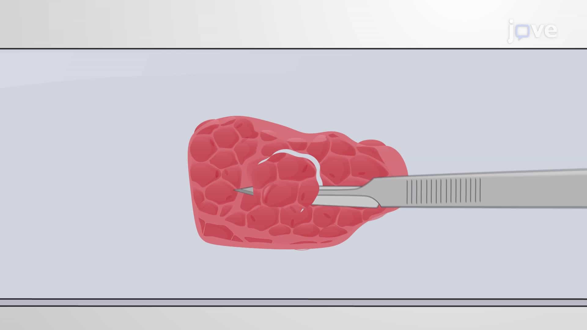 FFPE Tumor Tissue Macrodissection: A Technique to Obtain Specific Tumorous Tissue from Unstained Specimens