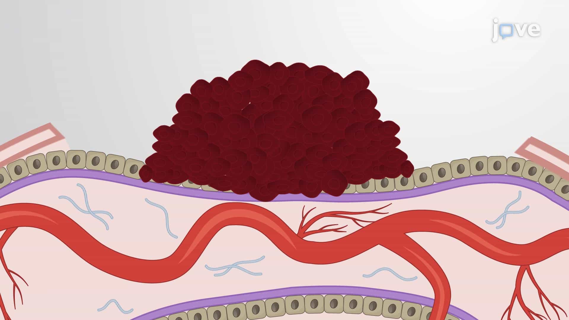 Chick Chorioallantoic Membrane Harvest: A Method to Isolate Tumor Graft-bearing Chorioallantoic Membrane from Chicken Egg
