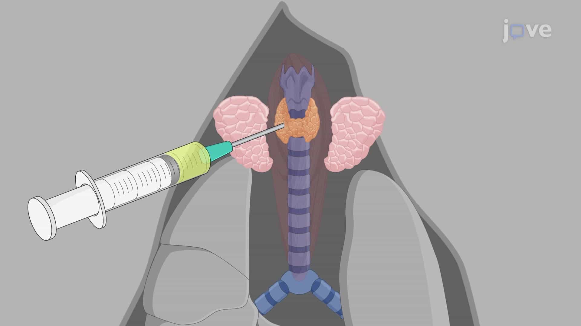 Orthotopic Inoculation of Thyroid Cancer Cells into Murine Thyroid: A Procedure to Establish Orthotopic Thyroid Cancer Mouse Model