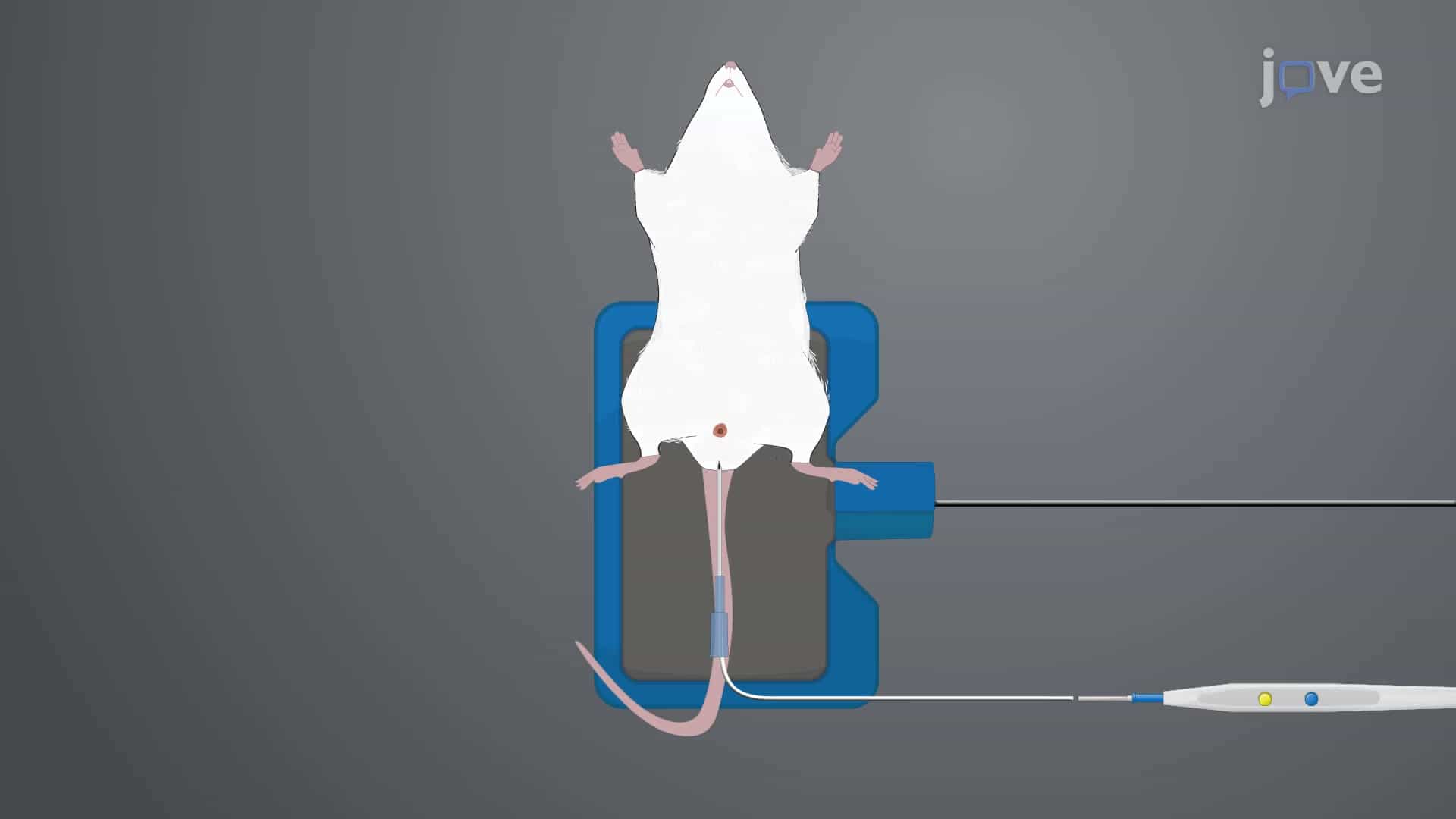 Patient-derived Tumor Xenografting: A Technique to Generate Experimental Mouse Model for Evaluating Urothelial Cell Carcinoma