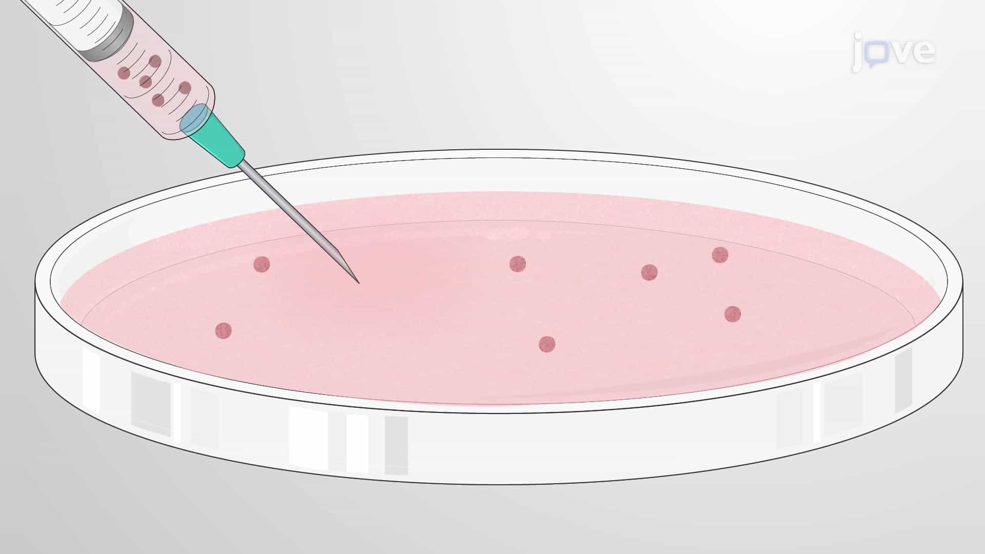 Bladder Tumor Organoid Model: A Method for Orthotopic Transplantation of Bladder Organoids into Recipient Murine Bladder