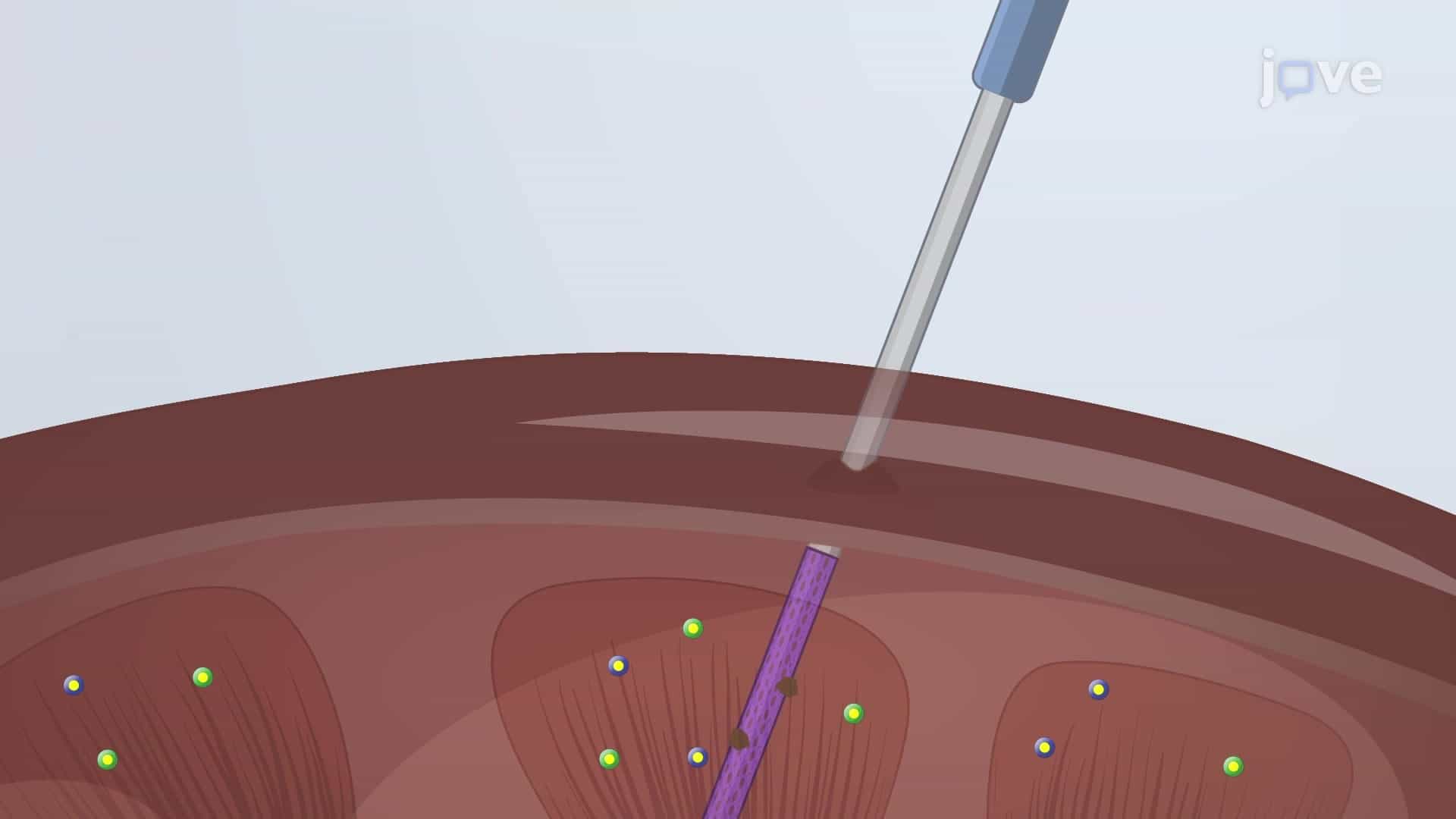 Solid Phase Microextraction Sampling: A Probe-based Technique for Sample Extraction from Graft Tissues