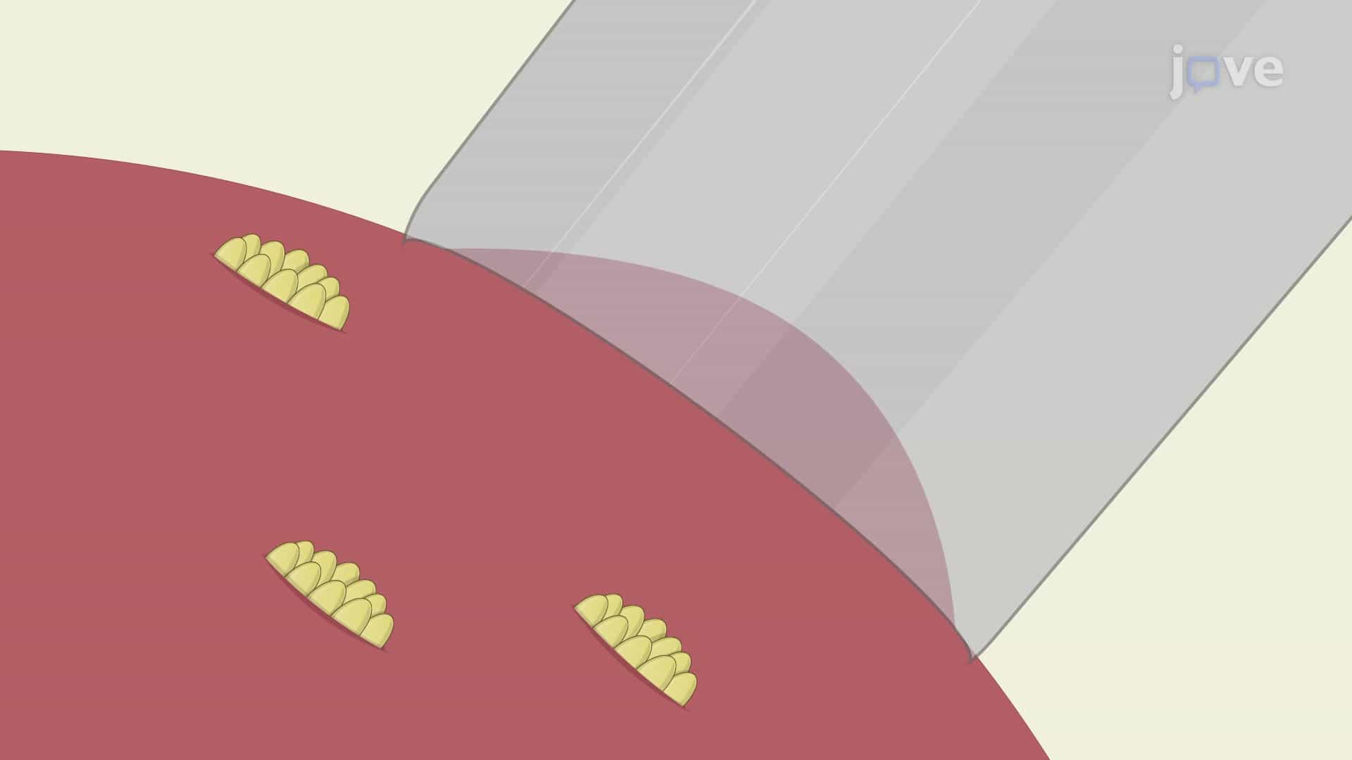 Amphotericin-B Mediated Perforated Patch-Clamp Analysis: An Electrophysiological Technique to Study Ionic Currents in Urinary Bladder Cells