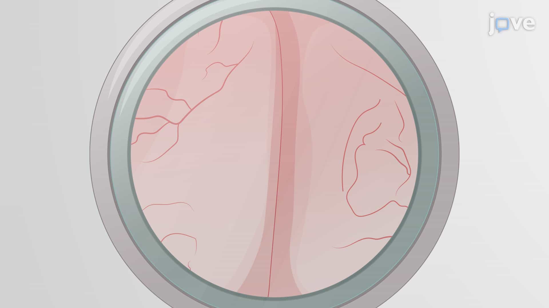 Implantation of Cranial Imaging Window in Mouse Model: A Surgical Procedure to Implant Glass-based Coverslip for Stable Optical Access to Regions of Murine Brain