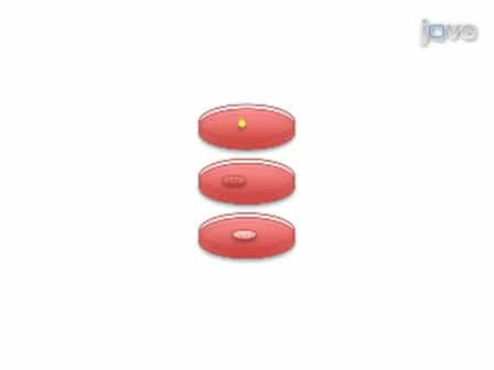Transurethral Induction of Mouse Urinary Tract Infection