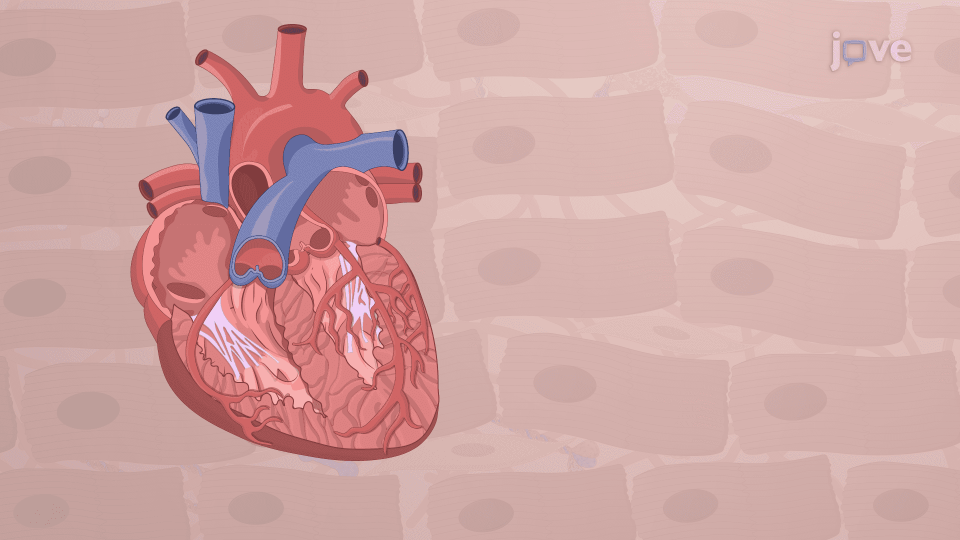 Surgical Aortic Debanding: A Procedure to Study Left Ventricular Reverse Remodeling in Murine Model of Aortic Constriction