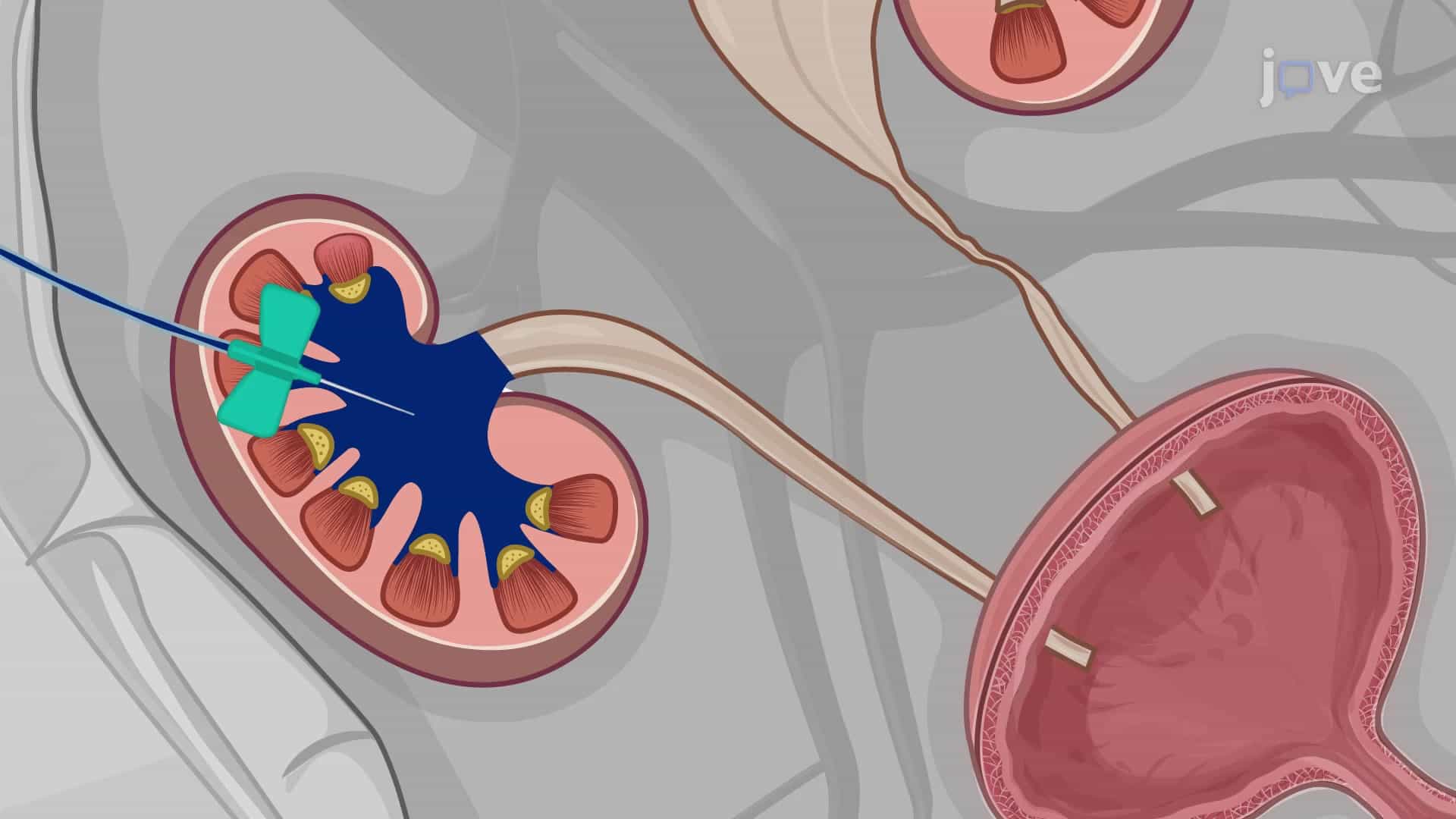 Methylene Blue Dye Injection in Mouse Embryonic Urinary Tract: A Method To Assess the Congenital Obstruction in the Urinary Tract