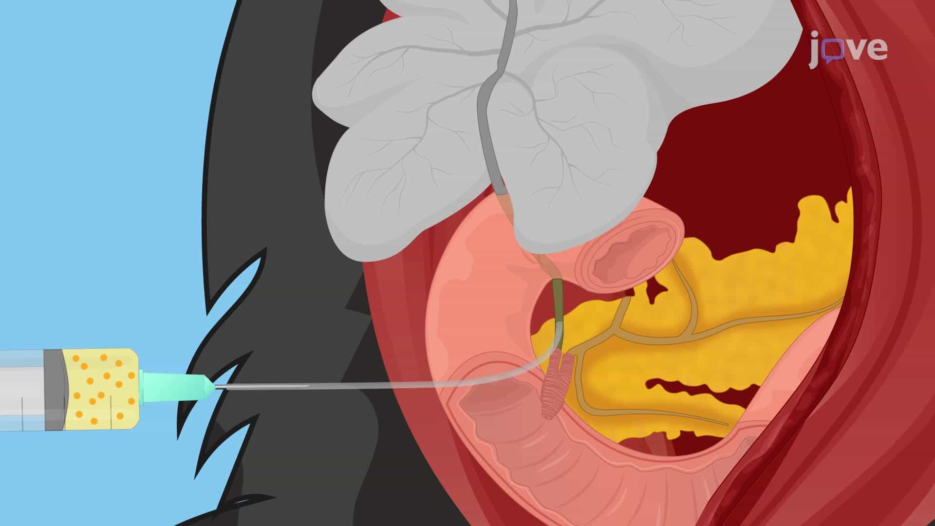 Biliary System Resin Casting: A Technique for Analyzing 3D Architecture of Biliary System in Murine Model Using Radiopaque Resin Injection