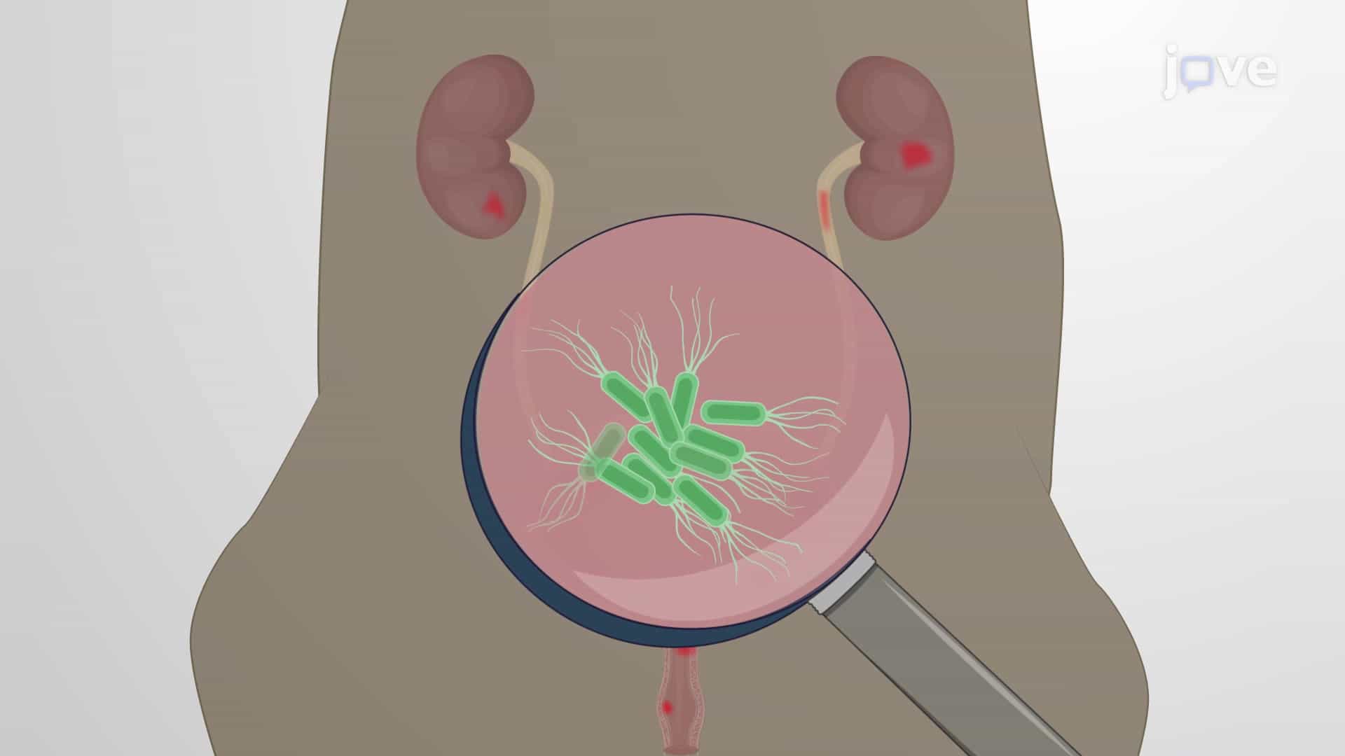 Generating Urinary Tract Infection Model: A Technique to Administer Uropathogenic Bacteria in Mouse to Develop Urinary Tract Infection Model