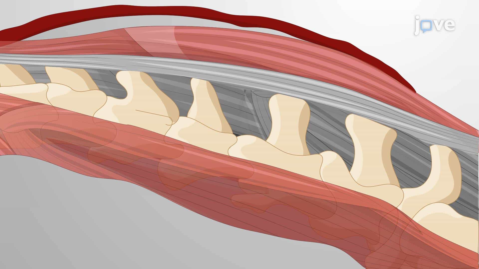 Surgical Induction of Lumbar Spine Instability in Mouse Model: A Surgical Procedure for the Resection of the Lumbar Spinous Processes and Connected Ligaments in Murine Model