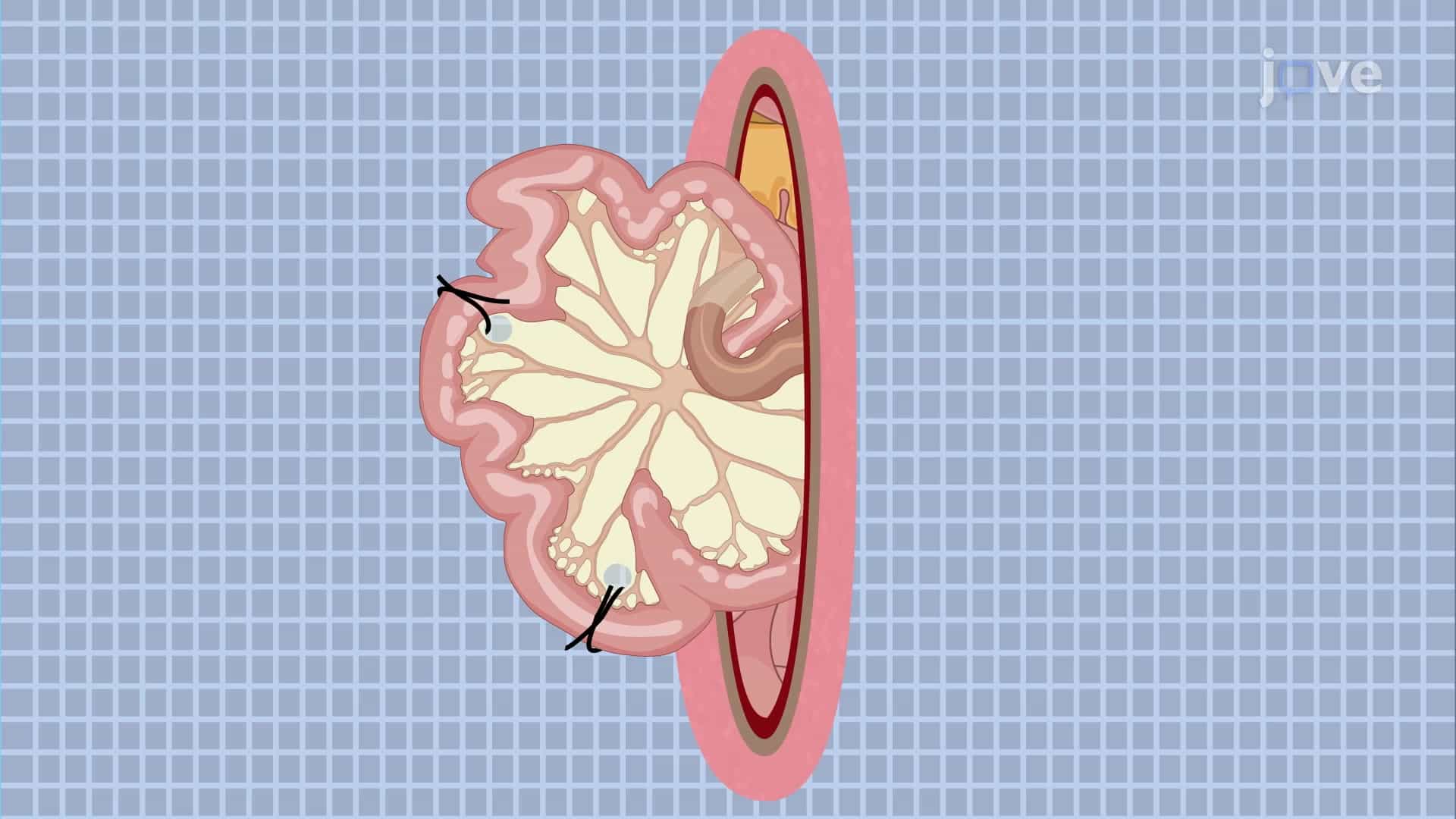 Mouse Ileal Loop Model: A Surgical Model to Study Intestinal Permeability in the Mouse