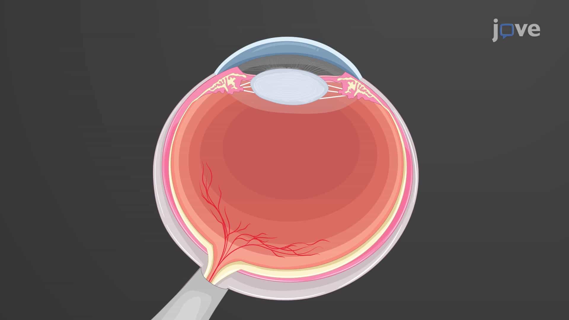 Isolating RPE and IPE Cells from Bovine Eye: A Procedure to Harvest and Culture Bovine Primary Pigment Epithelial Cells