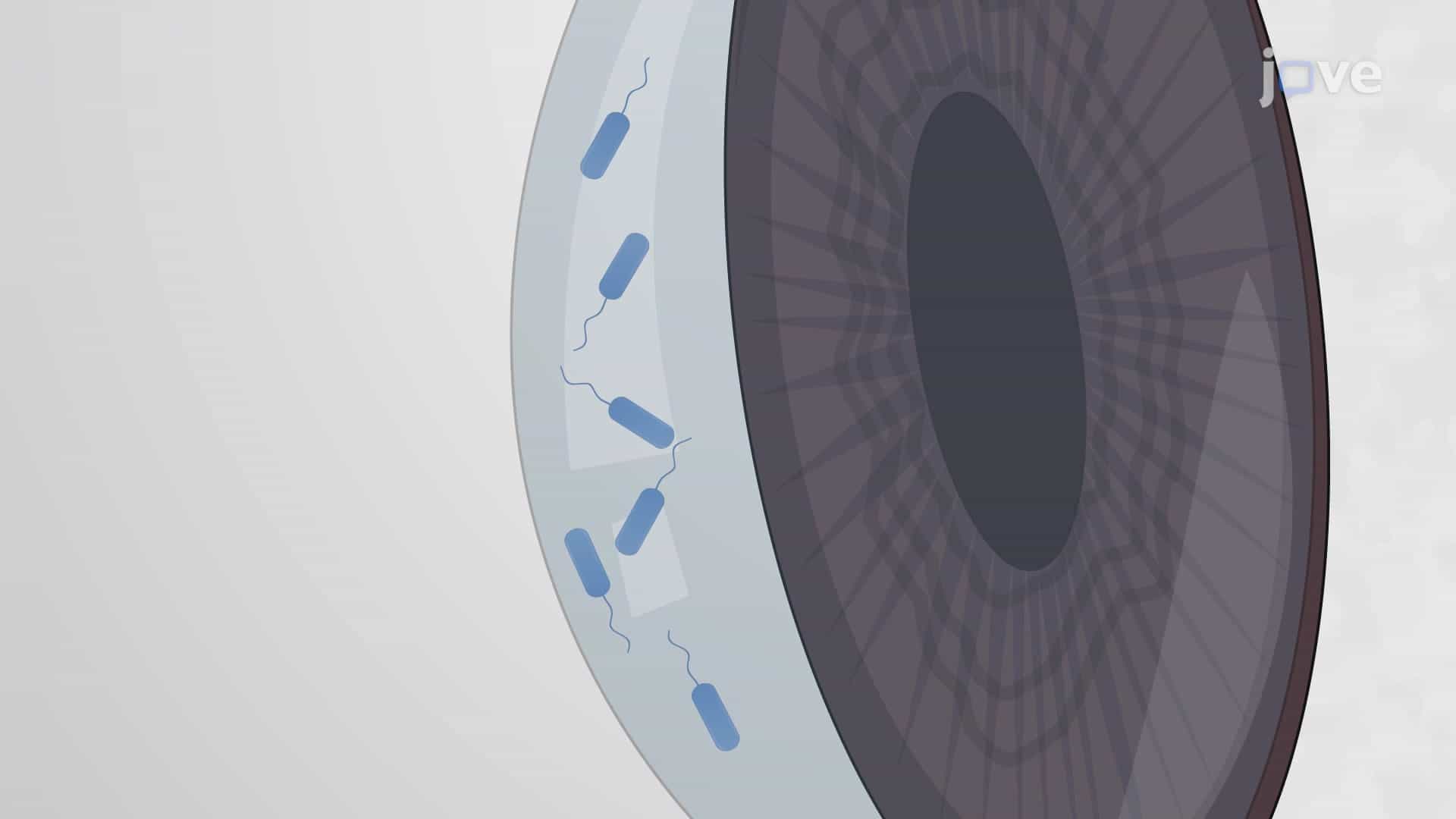 Porcine Ex vivo Cornea Model of Bacterial Keratitis: A Technique to Establish Bacterial Infection in Corneal Epithelial Cells
