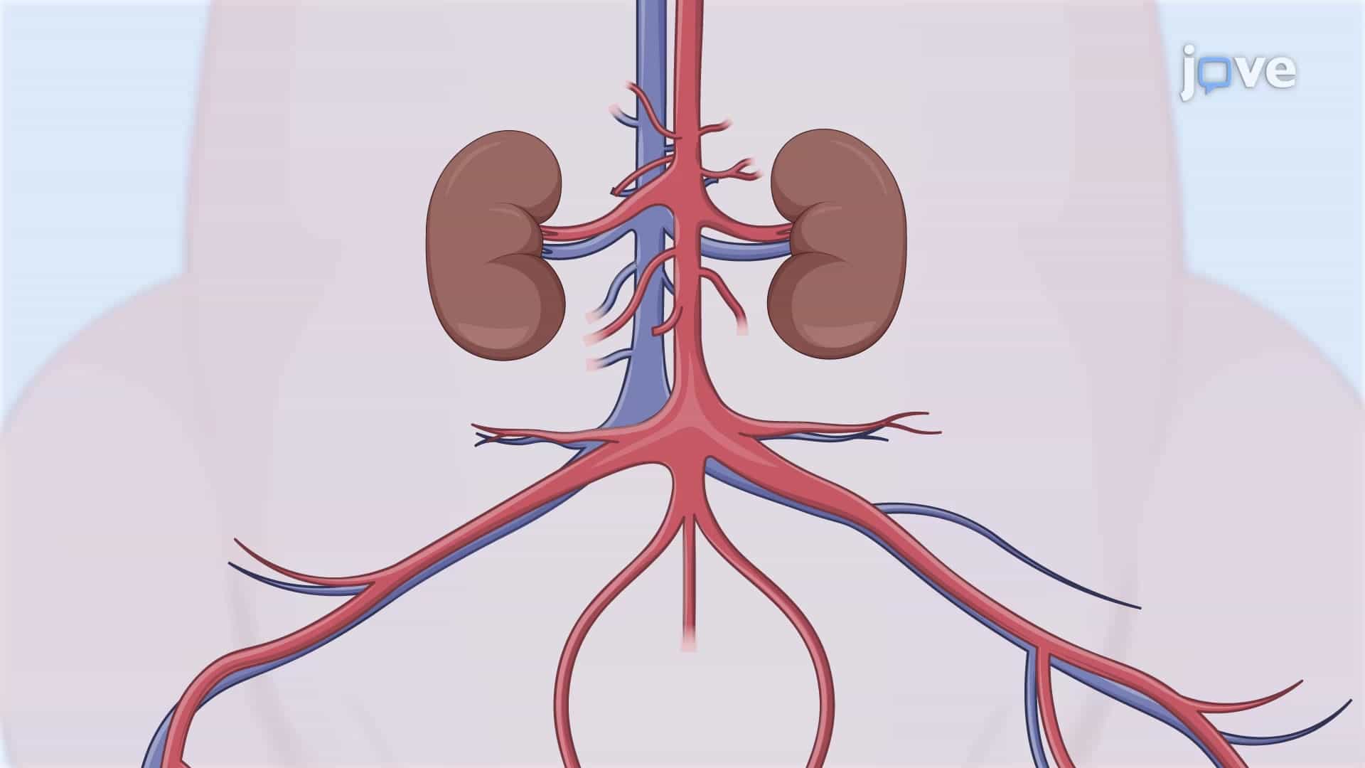 Exposing Infrarenal Abdominal Aorta in Porcine Model: A Surgical Procedure to Access Porcine Infrarenal Abdominal Aorta for Further Studies