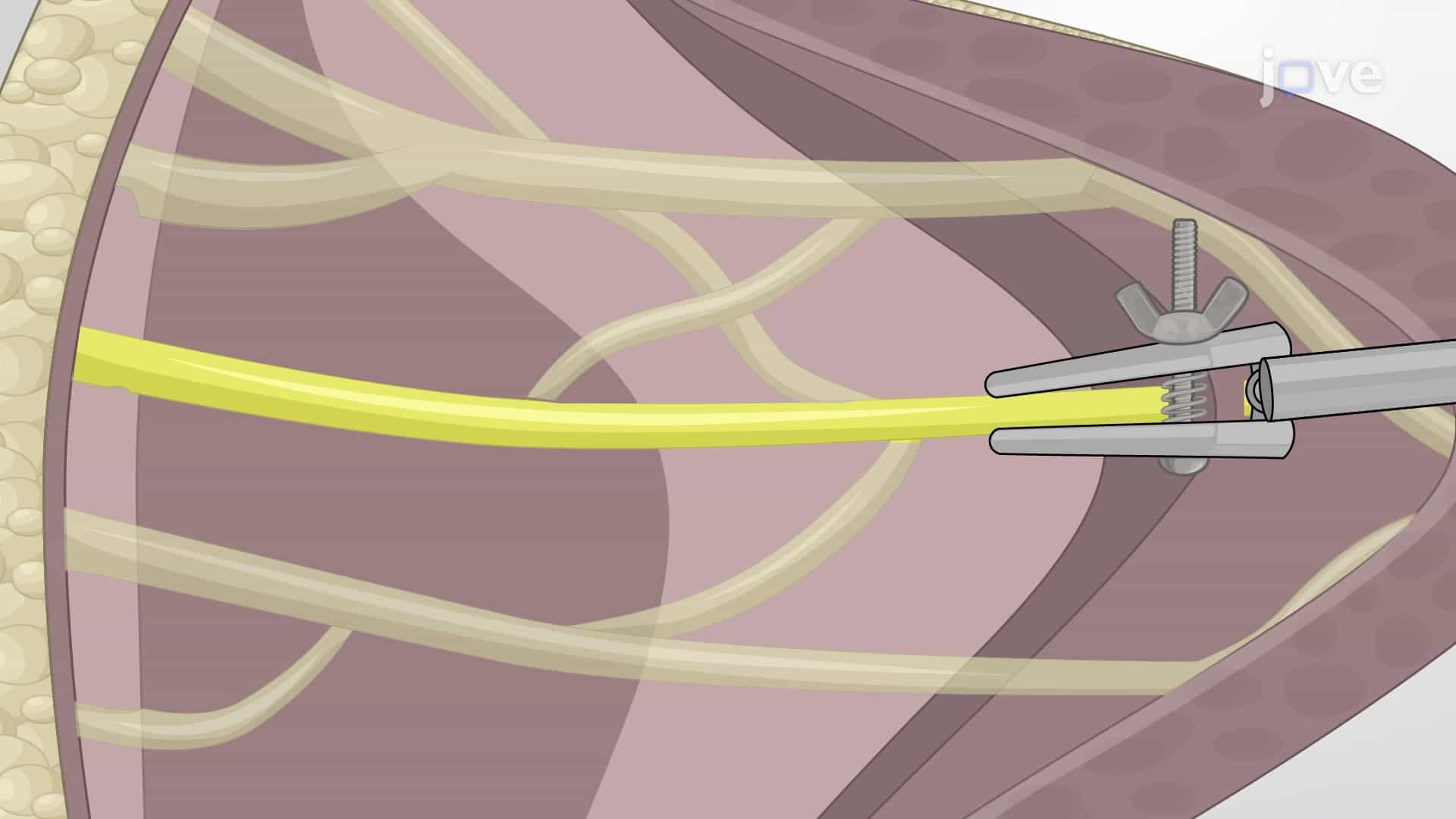 In Vivo Biomechanical Testing of Nerve: A Procedure for Biomechanical Analysis of Brachial Plexus Nerve Injury in a Neonatal Pig Model
